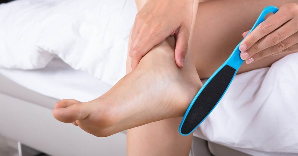 Eliminar callos con lima para callos - pasos para tratamiento en casa